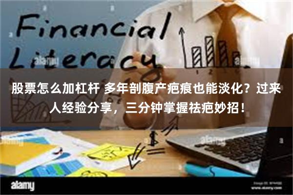 股票怎么加杠杆 多年剖腹产疤痕也能淡化？过来人经验分享，三分钟掌握祛疤妙招！